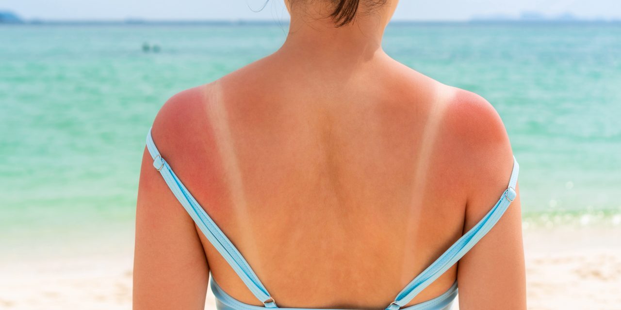 Sun damage and what your skin is telling you